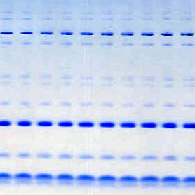Tris-Tricine Gels (Gradient)