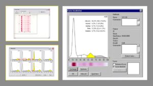TurboScan Software Densitometer (computer and scanner not included)